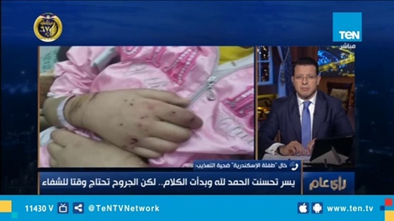 خال الطفلة 'ضحية الإسكندرية' - والدها ربطها وتركها في البلكونة يومين في عز النوة