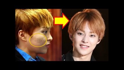 List 20 Idols Whose Skin Was Tragically Damaged By Makeup