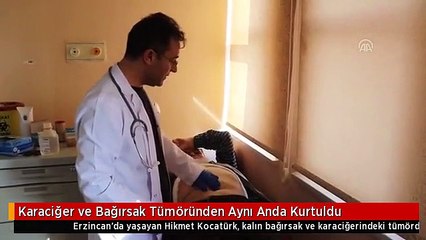 Karaciğer ve Bağırsak Tümöründen Aynı Anda Kurtuldu