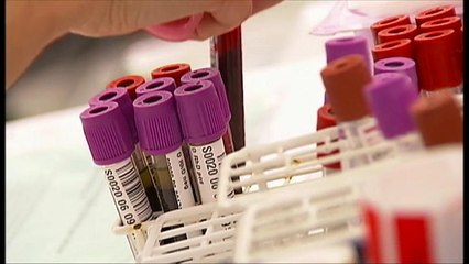 Bessere Früherkennung bei Prostatakrebs?