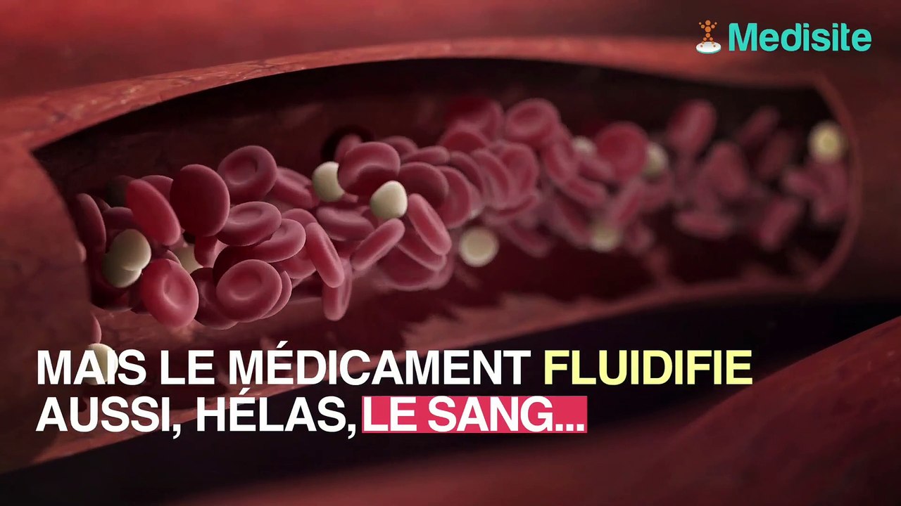 Aspirine : attention aux risques d'hémorragies