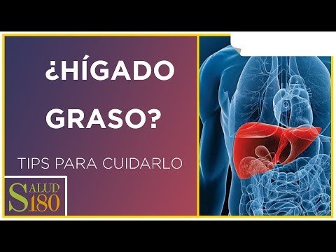 ¿Qué debemos hacer cuando tenemos Hígado graso? | Salud180