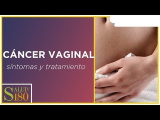 Cáncer vulvar,: síntomas y tratamiento | Salud180