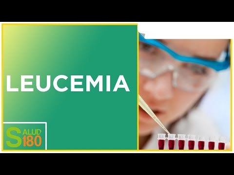 Leucemia: síntomas y tratamientos | Salud180