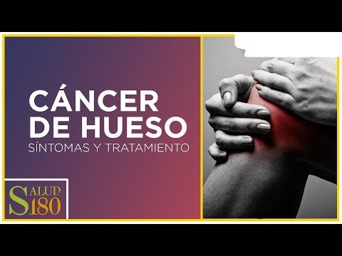 Cáncer de hueso y sus características | Salud180