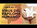 VPH se genera por culpabilidad | Salud180