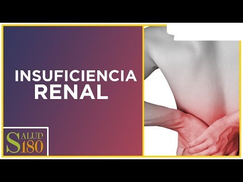 Tipos de cálculos urinarios | Salud180