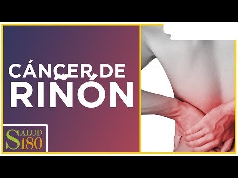 Cáncer renal, características y diagnóstico | Salud180