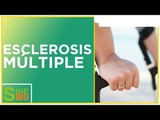 Esclerosis múltiple: síntomas y tratamiento | Salud180