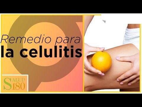 Remedio casero para la celulitis | Salud180
