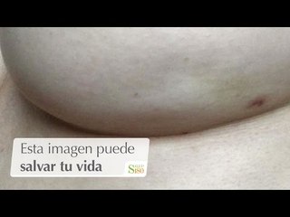 Esta imagen puede salvar tu vida | Salud180