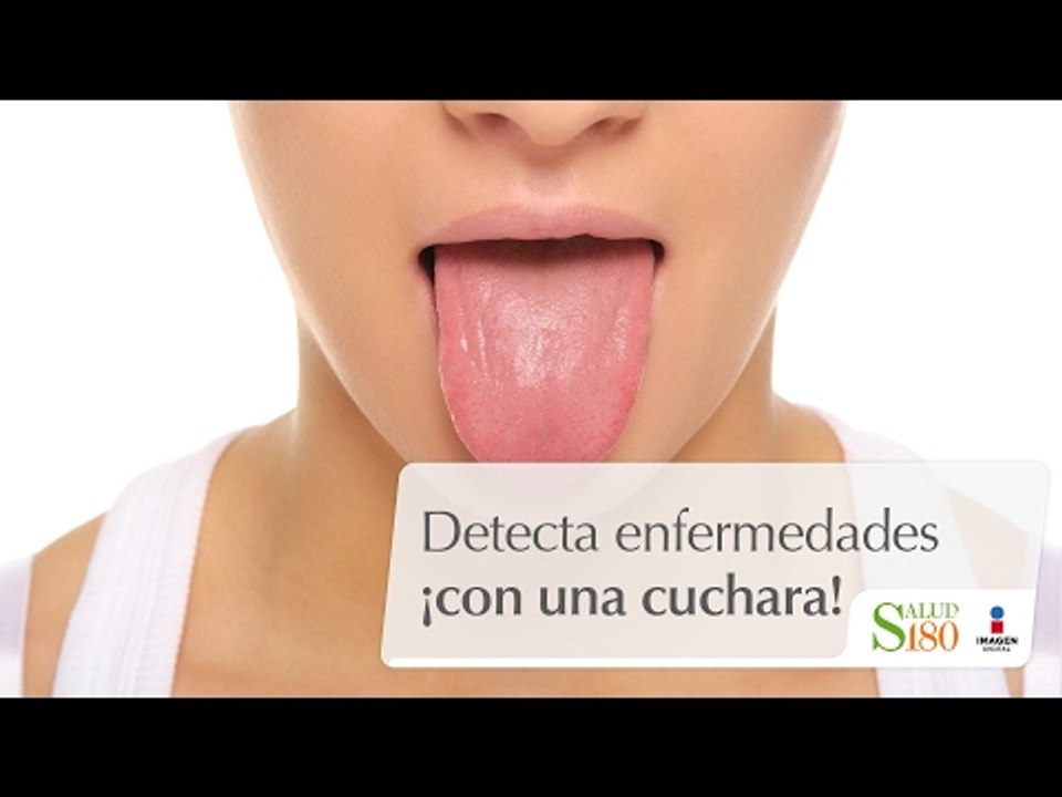 Detecta enfermedades ¡con una cuchara! | Cortos por Salud180