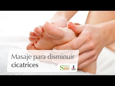 Masaje para disminuir cicatrices | Relájate | Salud 180
