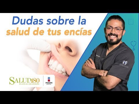 Doctor Salud | Cuidado de las encías | Salud180