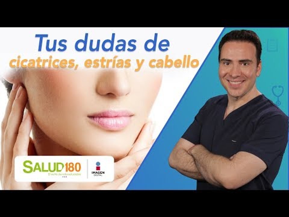 Dr. Salud | Estrías, cicatrices y cabello | Salud180