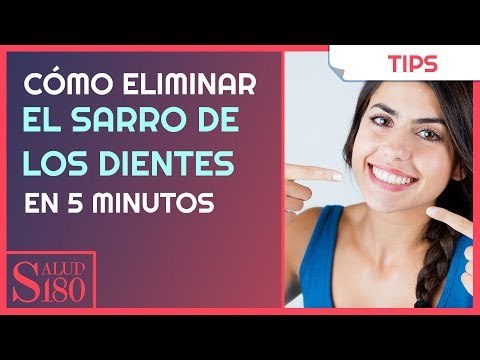 Cómo eliminar el sarro de los dientes en 5 minutos | Salud180