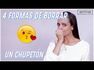 ¿Cómo borrar un chupetón en minutos? | ActitudFem