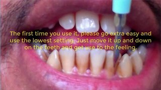 Remove Brown Teeth Stains In Under 10 Minutes Guaranteed!