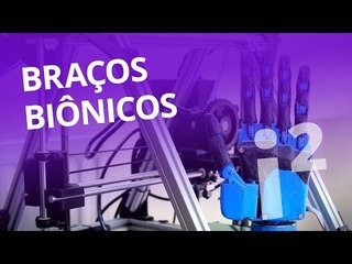 Braços biônicos com sensibilidade (#9 pt 3) [Inovação ²]