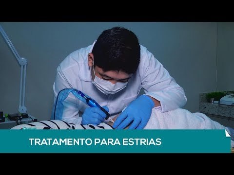 Lente: Tratamento para Estrias