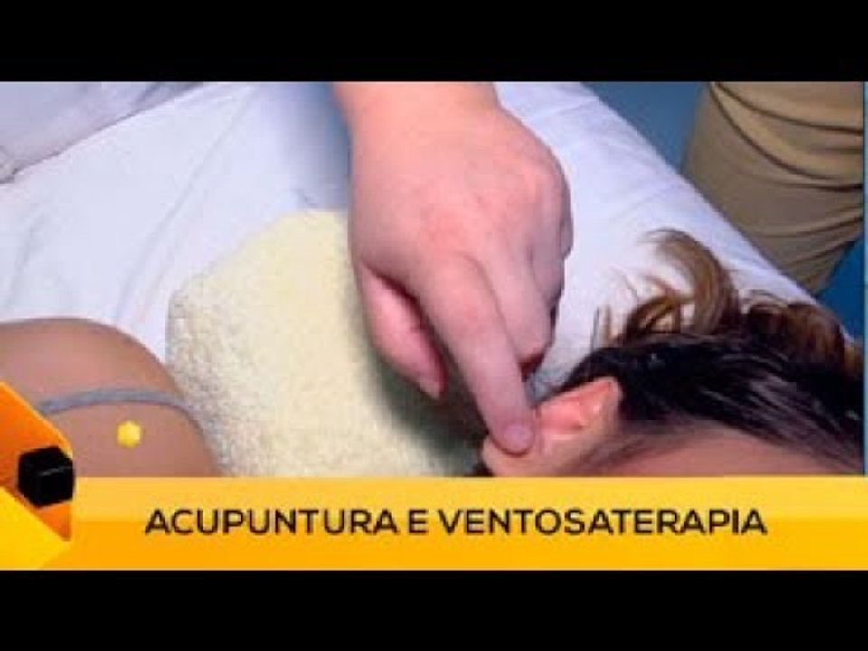 Fui!: Acupuntura e Ventosaterapia (3 de 3)