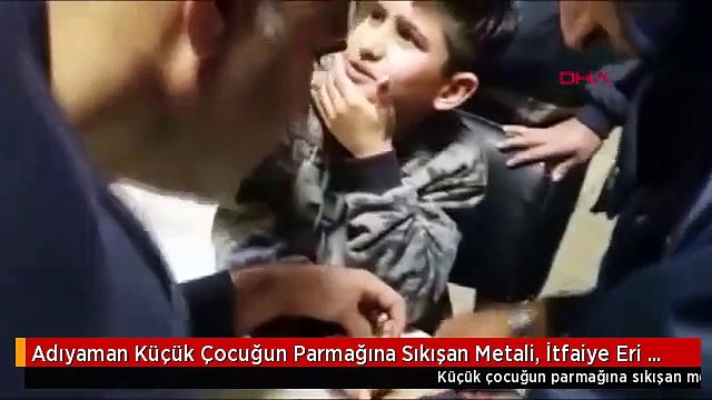 Adıyaman Küçük Çocuğun Parmağına Sıkışan Metali, İtfaiye Eri Çıkardı