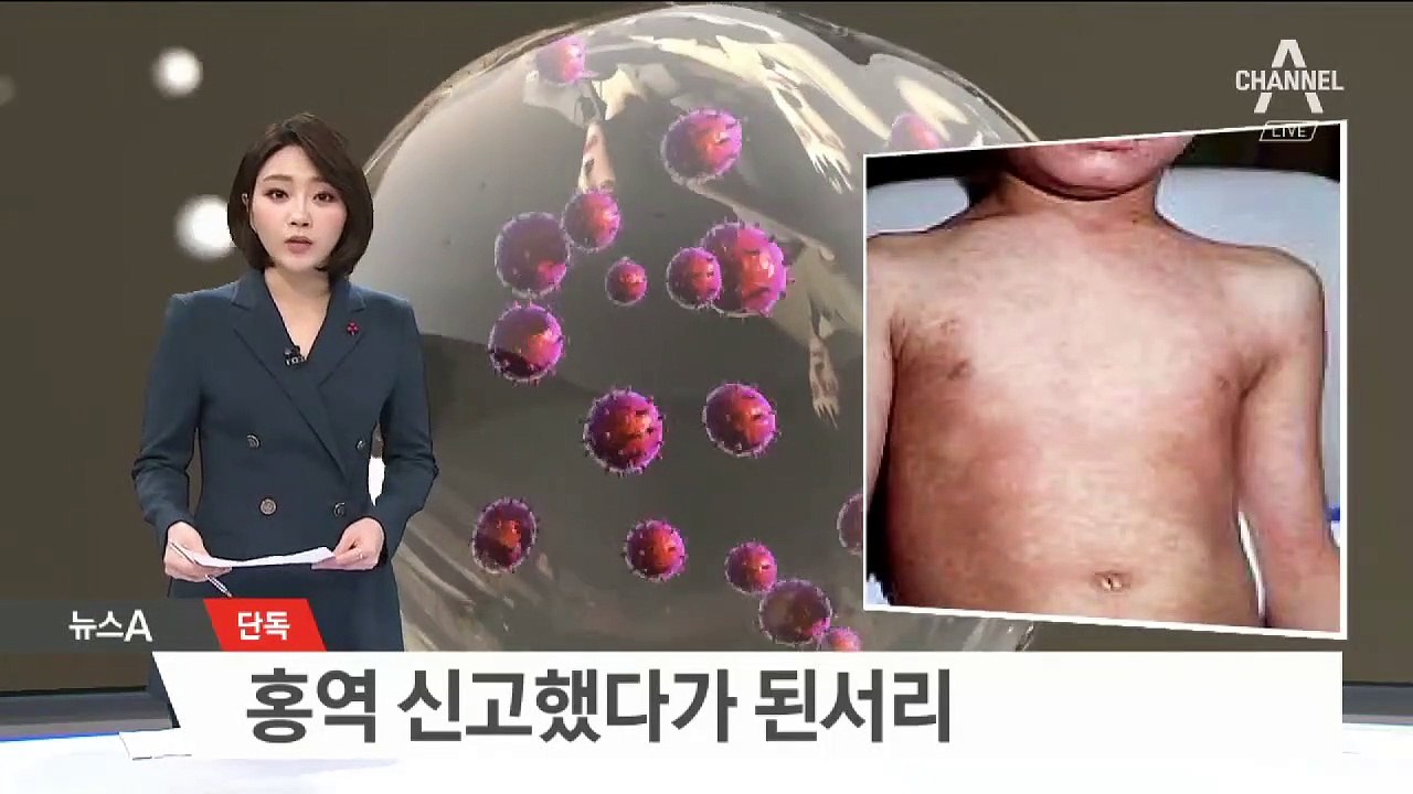 [단독]홍역 신고했다가…시장 실수로 피해 본 병원