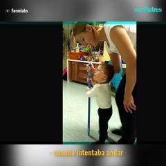 LA ESPERANZA DE LAS PRÓTESIS EN 3-D