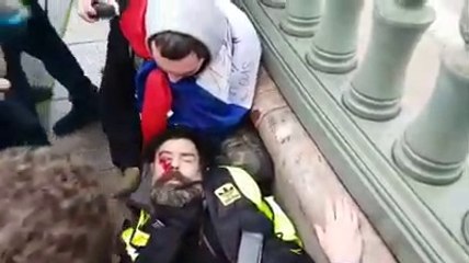 Le leader des Gilets Jaunes Jérôme Rodrigues  a été touché en pleine tête par un tir de flashball à Paris