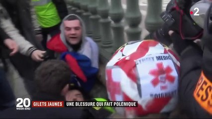 "Gilets jaunes" : la blessure à l'œil de Jérôme Rodrigues fait polémique