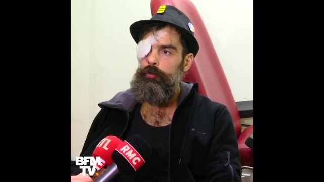 Quelles sont les deux versions autour de la blessure du gilet jaune Jérôme Rodrigues ?
