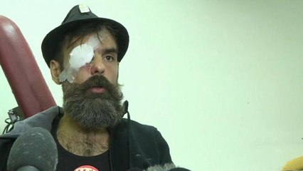 Polémica represión antidisturbios en Francia