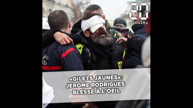 «Gilets jaunes»: Jérôme Rodrigues blessé à l’œil lors de l'acte XI