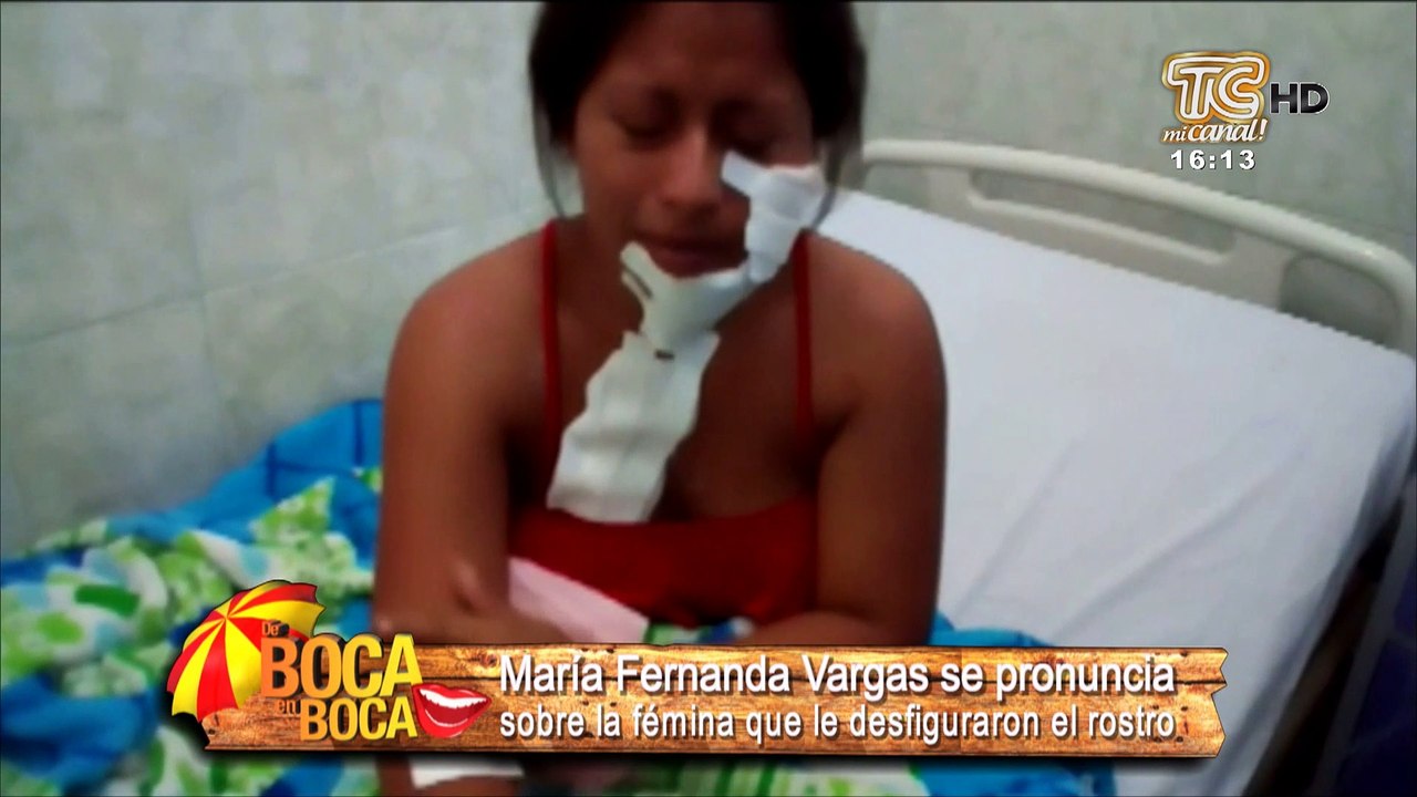 María Fernanda Vargas se pronuncia sobre la fémina que le desfiguraron el rostro