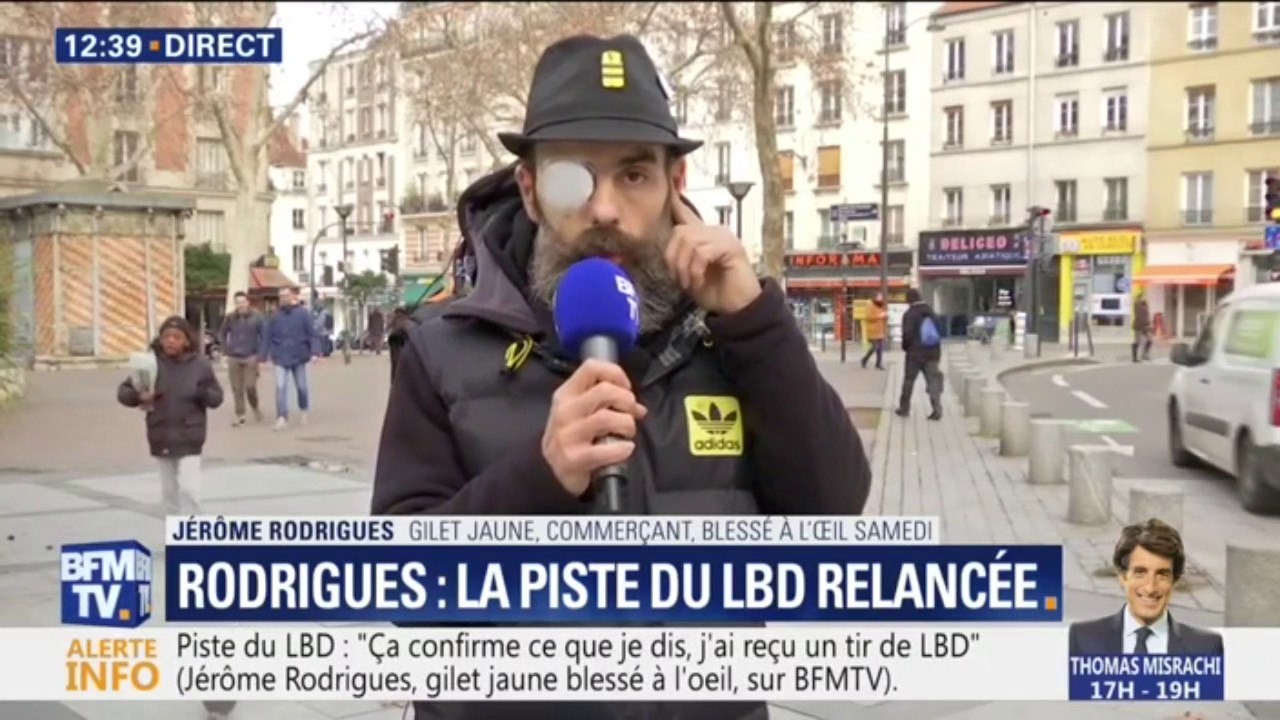 "J'ai perdu l'iris." Jérôme Rodrigues ne sait pas encore s'il retrouvera la vue de son œil droit