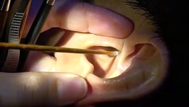 강릉출장안마-{ 카톡vvv51 } ⊀Ö7Ô-7575-0075⊁강릉출장마사지'20대'강릉출장안마출장안마코스강릉출장안마강릉출장마사지-황제강릉출장마사지-강릉콜걸.