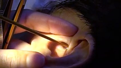 양양출장안마-{ 카톡vvv51 }  ⊀Ö7Ô-7575-0075⊁양양출장마사지'20대'양양출장안마출장안마코스양양출장안마양양출장마사지-황제양양출장마사지-양양콜걸.