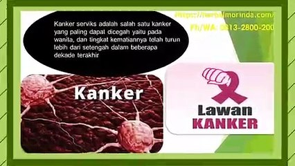 Cara Mengobati Kanker Serviks Stadium Awal