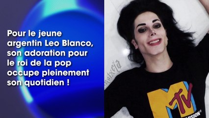 Mickael Jackson : un fan dépense 30 000$ en chirurgie pour lui ressembler, le résultat dévoilé