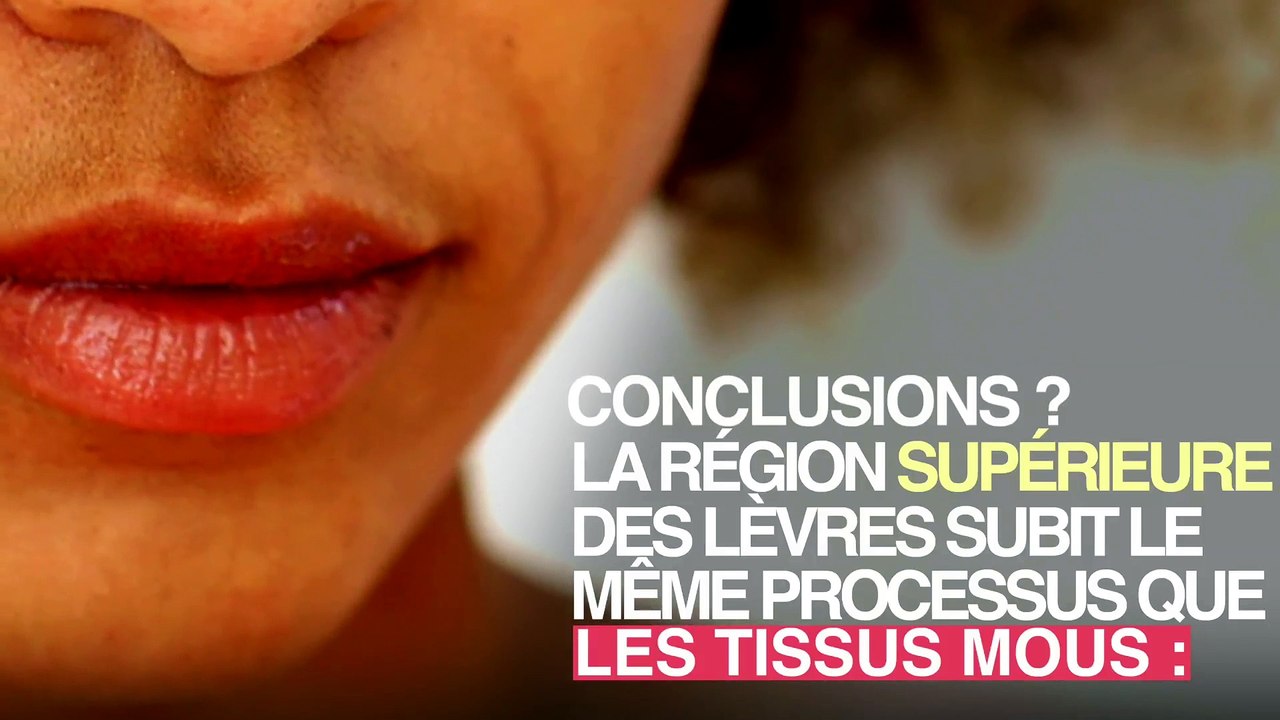 Bouche : pourquoi les lèvres s'affinent avec l'âge