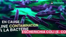 Alerte : des moules contaminées à l'E.Coli