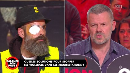 Éric Naulleau est pour la loi anti-casseurs, il explique pourquoi