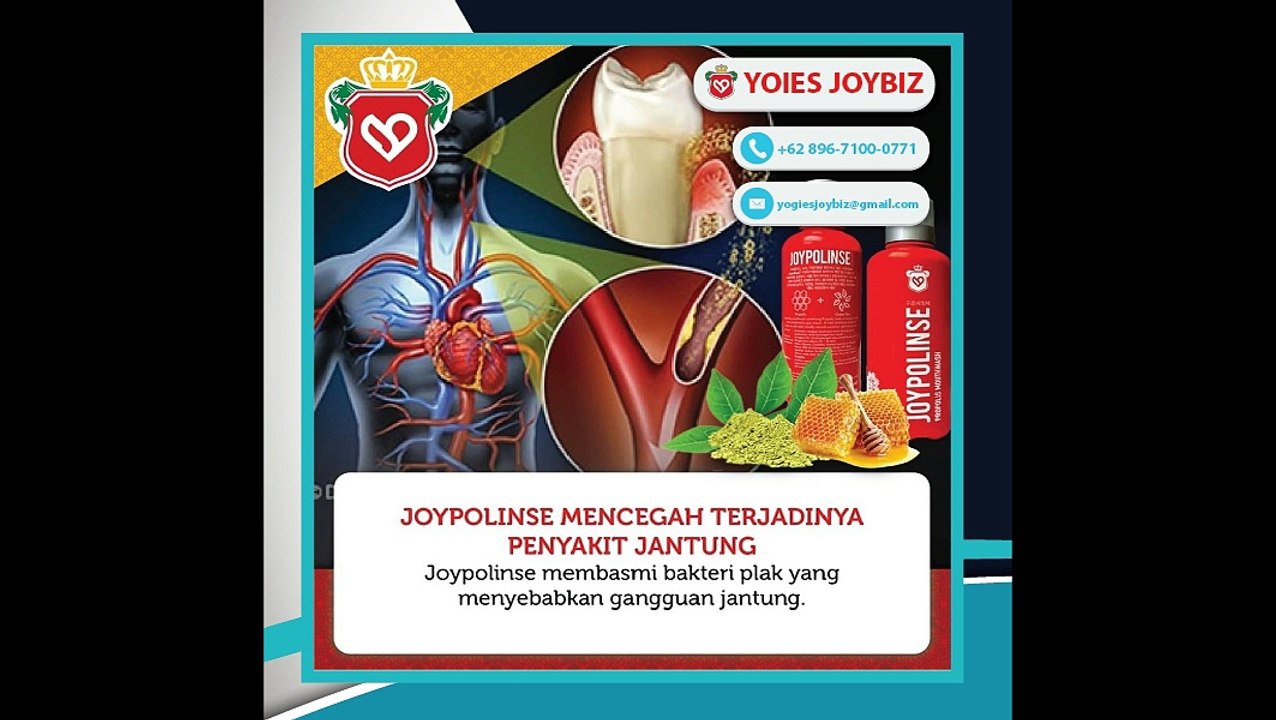 PROMO!! 0818-2040-55 | Yogies Joypolinse Bangka Selatan, Membersihkan Plak Gigi/ Karang Gigi