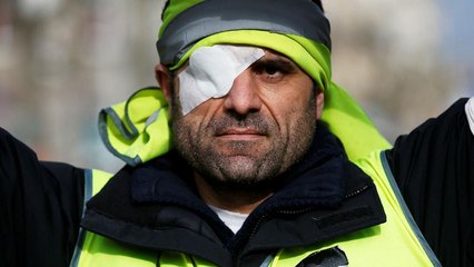 دوازدهمین خیزش جلیقه‌زردها برای حمایت از مجروحان چند مجروح بر جای گذاشت