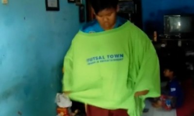 Dialog: Ragam Cara Menangani Kelebihan Berat Badan (Bag. 2)
