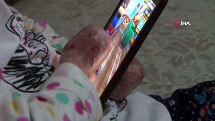 Kelebek hastası kızlarına 'kelebek' gibi bakıyorlar