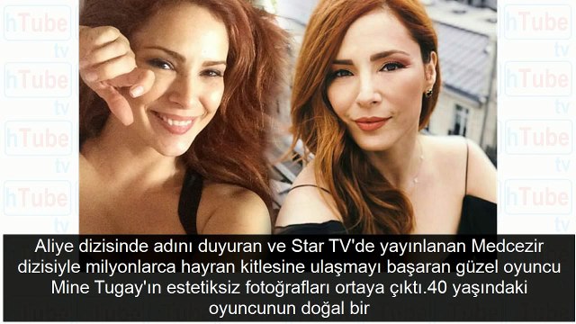 Herkes onu doğal güzel sanıyordu! Meğer Mine Tugay da estetik harikasıymış
