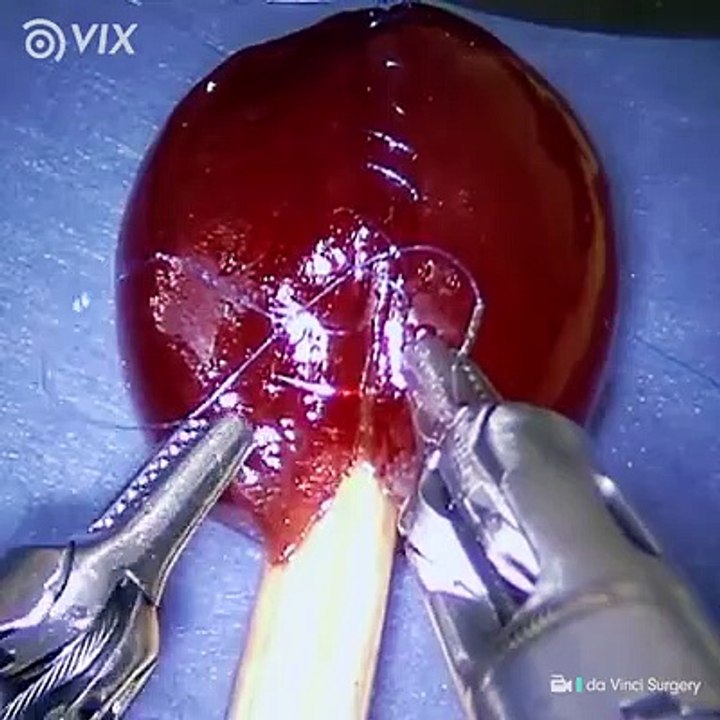 Medicina do futuro, no presente