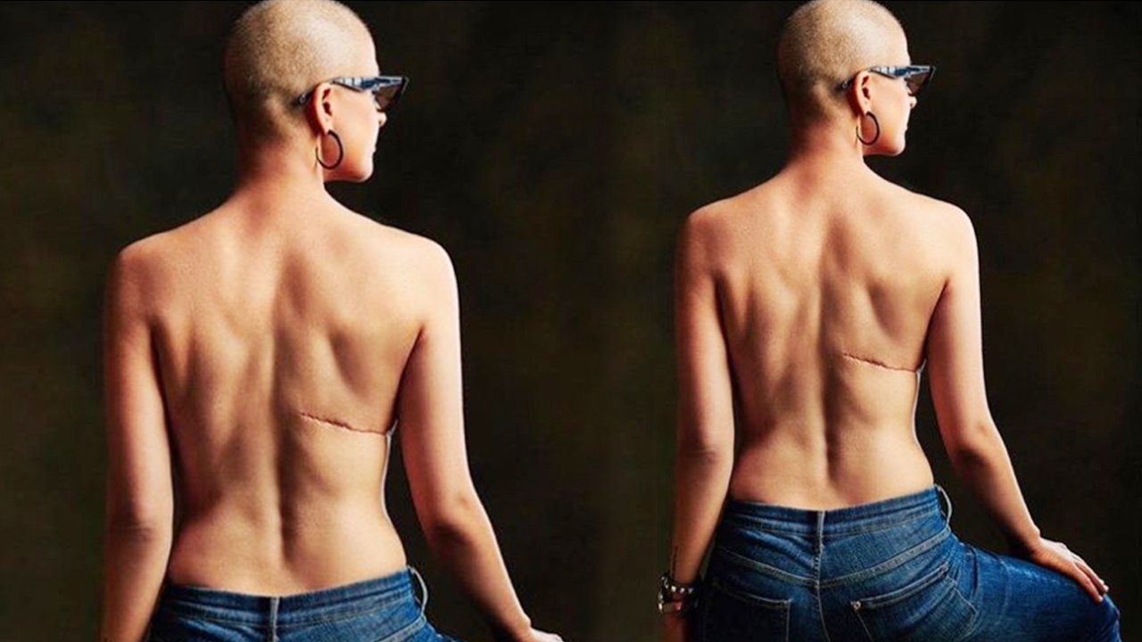 World Cancer Day: Ayushman Khurana shares Tahira Kashyap's picture; Check Out! | Boldsky