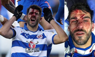 لحظة تشويه لاعب بالدوري الإنجليزي وجه خصمه